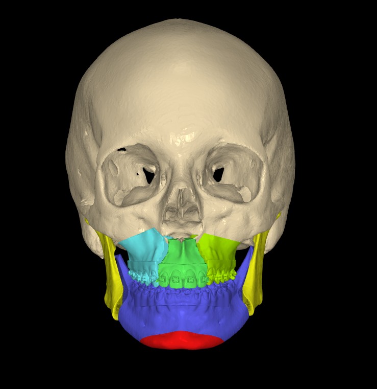 Double-jaw multi-piece planning